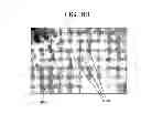 Fig. 11 - Methods, Systems and Devices for Separating Tumor Cells
