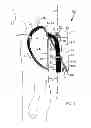 Fig. 17 - Backpack