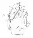 Fig. 01 - SHOULDER BAG WITH IMPROVED ACCESS