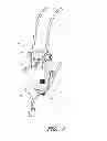 Fig. 02 - Pipe-to-pipe brace assembly