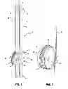 Fig. 02 - Actuation and Valve Mechanism