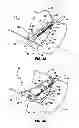 Fig. 17 - Actuation and Valve Mechanism