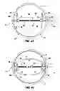 Fig. 18 - Actuation and Valve Mechanism