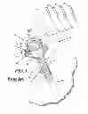 Fig. 02 - Trocar and cannula assembly having improved conical valve, and methods related thereto