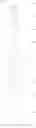Fig. 25 - Composition containing borane compound and conjugated polymer compound, and element