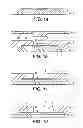 Fig. 02 - Methods of manufacturing transistors including forming a depression in a surface of a covering of resist material