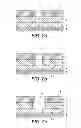 Fig. 04 - Methods of manufacturing transistors including forming a depression in a surface of a covering of resist material