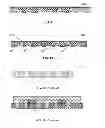 Fig. 04 - Pre-encapsulated etching-then-plating lead frame structure with island and method for manufacturing the same