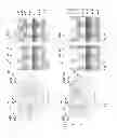 Fig. 05 - Forming vias and trenches for self-aligned contacts in a semiconductor structure