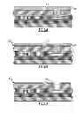 Fig. 06 - Methods for etching through-wafer vias in a wafer