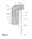 Fig. 05 - POUR IN PLACE HEADREST