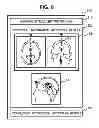 Fig. 09 - Medical image imaging device for positioning an imaging slice