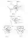 Fig. 06 - MEDIAL SURFACE GENERATION