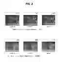Fig. 03 - Method and device for encoding a depth map of multi viewpoint video data, and method and device for decoding the encoded depth map