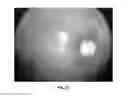 Fig. 03 - Method and system for detecting and capturing focused image