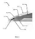 Fig. 07 - Multi-piece insert device with glue seal for ophthalmic devices