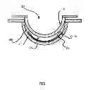 Fig. 02 - Multi-piece insert device with locking seal for ophthalmic devices