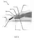 Fig. 06 - Multi-piece insert device with locking seal for ophthalmic devices