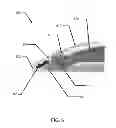Fig. 07 - Multi-piece insert device with locking seal for ophthalmic devices