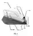 Fig. 09 - Multi-piece insert device with locking seal for ophthalmic devices