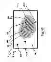 Fig. 17 - Vision measurement and training system and method of operation thereof