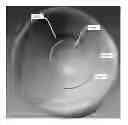 Fig. 01 - Prosthetic lenses and methods of making the same