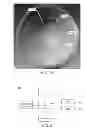 Fig. 06 - Prosthetic lenses and methods of making the same