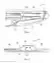 Fig. 03 - Handheld device assembly