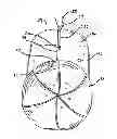 Fig. 01 - Lighted hat