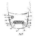 Fig. 14 - Lighted hat