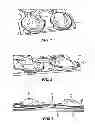 Fig. 06 - LED apparatus and method for accurate lens alignment