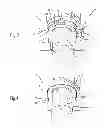 Fig. 04 - Securing a support and covering a lighting device