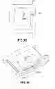 Fig. 08 - Talking Dome Watch for the Visually Impaired