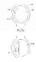 Fig. 12 - Talking Dome Watch for the Visually Impaired