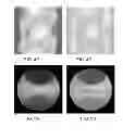 Fig. 04 - Computed tomography system with dynamic bowtie filter
