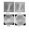 Fig. 05 - Computed tomography system with dynamic bowtie filter