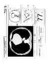 Fig. 10 - X-ray CT apparatus and optimal cardiac phase determining method