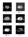 Fig. 08 - Apparatus and method for generating an attenuation correction map