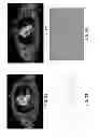 Fig. 10 - Apparatus and method for generating an attenuation correction map