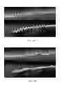 Fig. 12 - Methods and systems for transforming luminal images