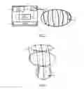 Fig. 03 - Method to estimate interfractional and intrafractional organ motion for adaptive external beam radiotherapy