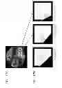 Fig. 13 - RECONSTRUCTION METHOD OF BIOLOGICAL TISSUE IMAGE, APPARATUS THEREFOR, AND  IMAGE DISPLAY APPARATUS USING THE BIOLOGICAL TISSUE IMAGE