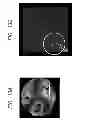 Fig. 14 - RECONSTRUCTION METHOD OF BIOLOGICAL TISSUE IMAGE, APPARATUS THEREFOR, AND  IMAGE DISPLAY APPARATUS USING THE BIOLOGICAL TISSUE IMAGE