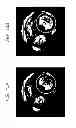 Fig. 16 - RECONSTRUCTION METHOD OF BIOLOGICAL TISSUE IMAGE, APPARATUS THEREFOR, AND  IMAGE DISPLAY APPARATUS USING THE BIOLOGICAL TISSUE IMAGE