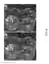 Fig. 09 - METHOD AND APPARATUS FOR DETERMINING THE RELATIONSHIP OF AN IMAGE TO A SET OF IMAGES