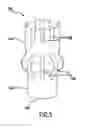 Fig. 06 - Fuel pump for an internal combustion engine