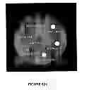 Fig. 08 - Compositions and methods for multimodal imaging