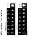 Fig. 161 - IMAGING PROTOCOLS