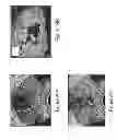 Fig. 48 - IMAGING PROTOCOLS
