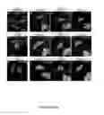 Fig. 15 - HUMAN INDUCED NEURONAL CELLS